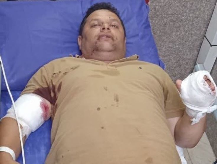 قاچاقچیان چوب یک مامور منابع طبیعی را در گیلان مجروح کردند قاچاقچیان چوب یک مامور منابع طبیعی را در گیلان مجروح کردند