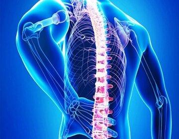 نخستین بار سند مکتوب پیشگیری از بیماری کمردرد توسط محققان در شهرکرد تدوین شد