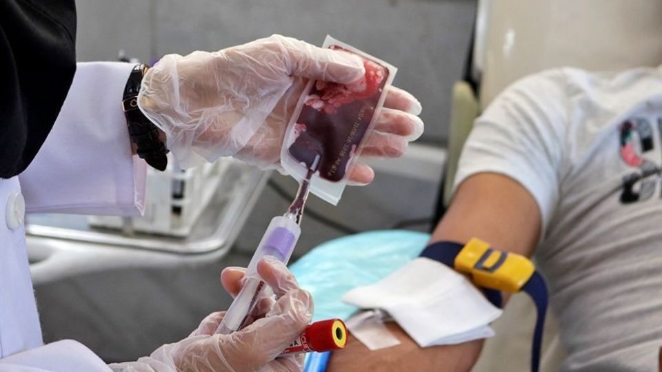 70th case of Bombay blood group identified in Iran