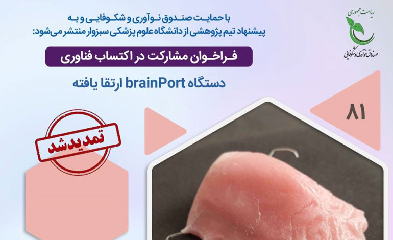 فراخوان ۲ طرح پژوهشی پوشش‌های نانوکامپوزیتی و دستگاه دوربین نابینایان