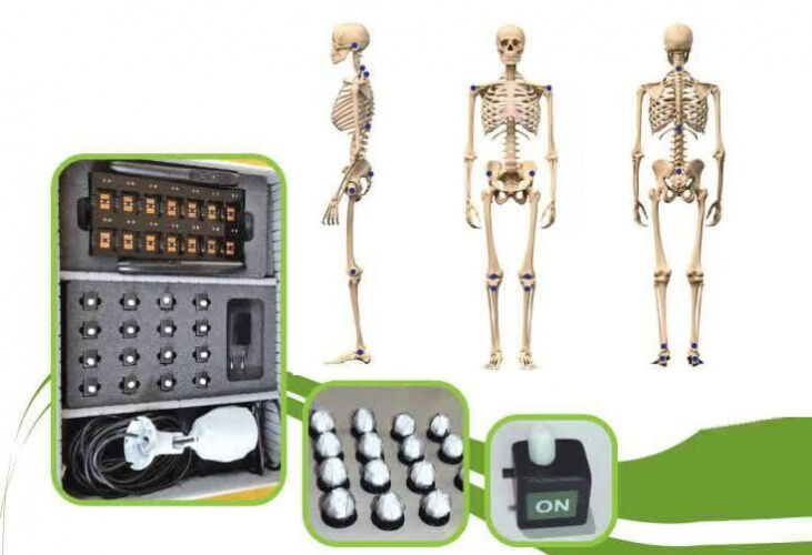 سامانه سنجش اختلالات اسکلتی در بیرجند بومیسازی شد سامانه سنجش اختلالات اسکلتی در بیرجند بومیسازی شد