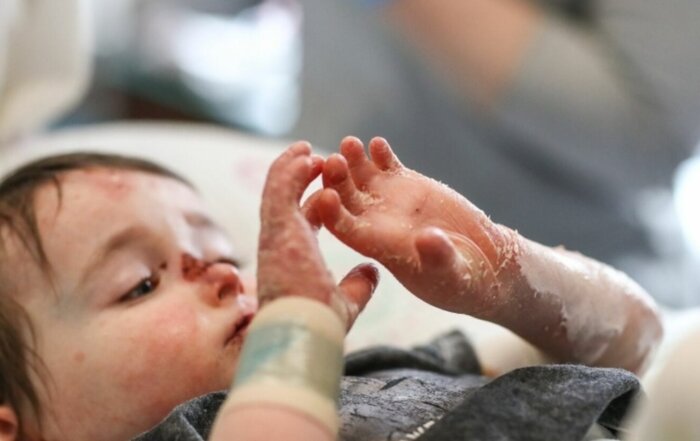 ۹۵ درصد بیماران «ای بی» حاصل ازدواج فامیلی/ امکان تشخیص پیش از تولد وجود ندارد