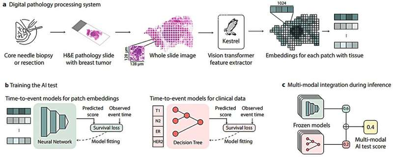 پیشبینی دقیقتر میزان پیشرفت سرطان پستان به مدد هوش مصنوعی