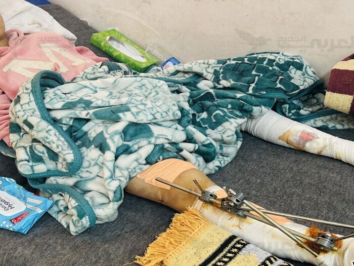 روایت غمبار دختربچه ۸ ساله/ تنها عضو نجات یافته یک خانواده در غزه