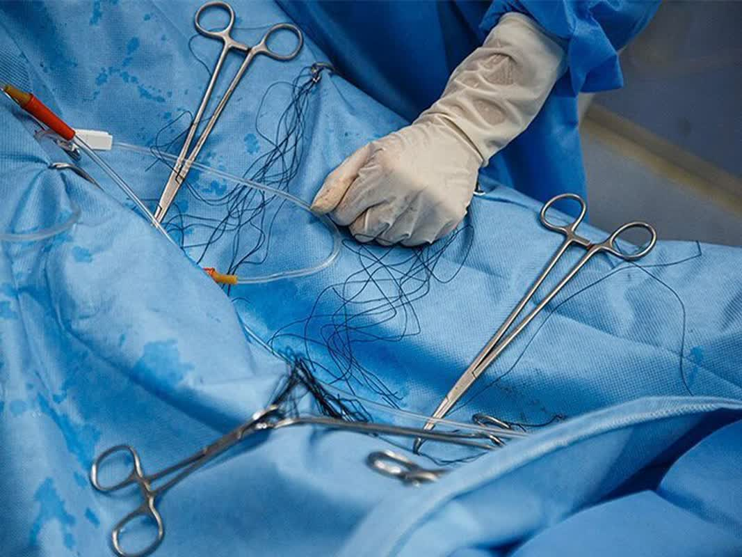 ۴۴ مرکز غیرمجاز دندانپزشکی و زیبایی در پاکدشت پلمب شد