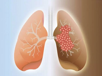 ترمیم اضافه کاری پرستاران گام مهم دولت/نابودی روزانه ۵۰۰ هکتار از سطح جنگلها