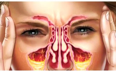 رنگ مخاط درباره وضعیت سلامت ایمنی شما چه میگوید؟