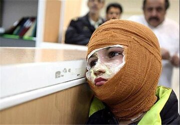 ۷۰ مصدوم در حوادث چهارشنبه سوری همدان/  ۲ نفر قطع عضو شدند