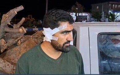 ضرب و شتم مامور منابع طبیعی باشت در درگیری با سودجویان 