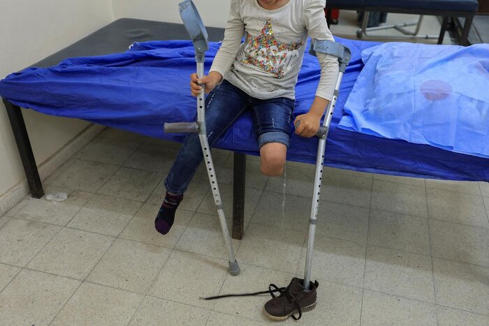 بحران انسانی در غزه/ افزایش افراد دارای نقص عضو در حملات رژیم صهیونیستی