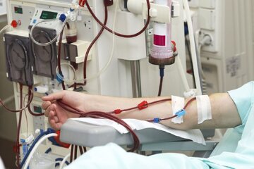 ۲۳۵ بیمار دیالیزی خراسان‌شمالی در جستجوی زندگی دوباره