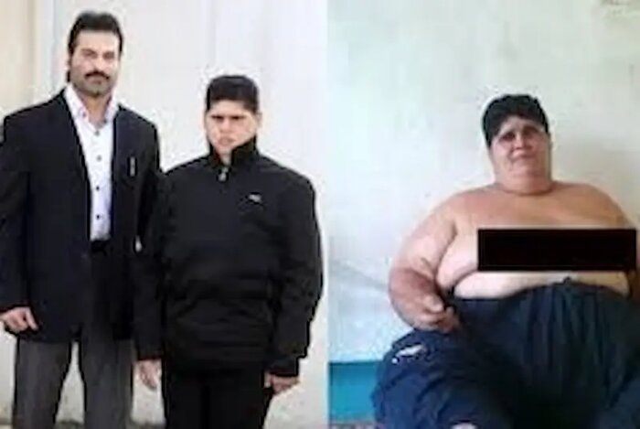 چاقی مفرط تا لاغری اصولی از مسیر عملهای تهاجمی نمیگذرد