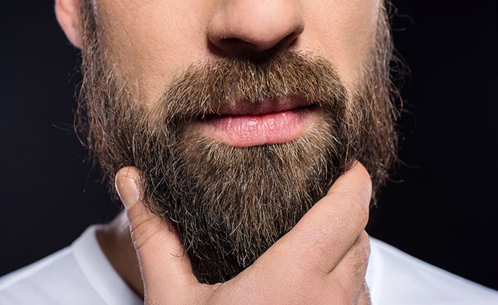 راهنمای کامل کاشت ریش