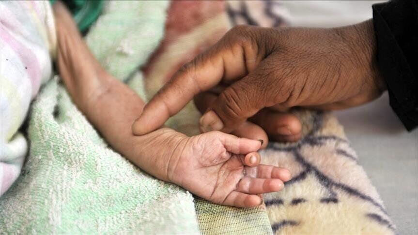 خراسان جنوبی از مناطق ناامن در برنامه غذایی/ شیوع لاغری در استان تا سه برابر میانگین کشور