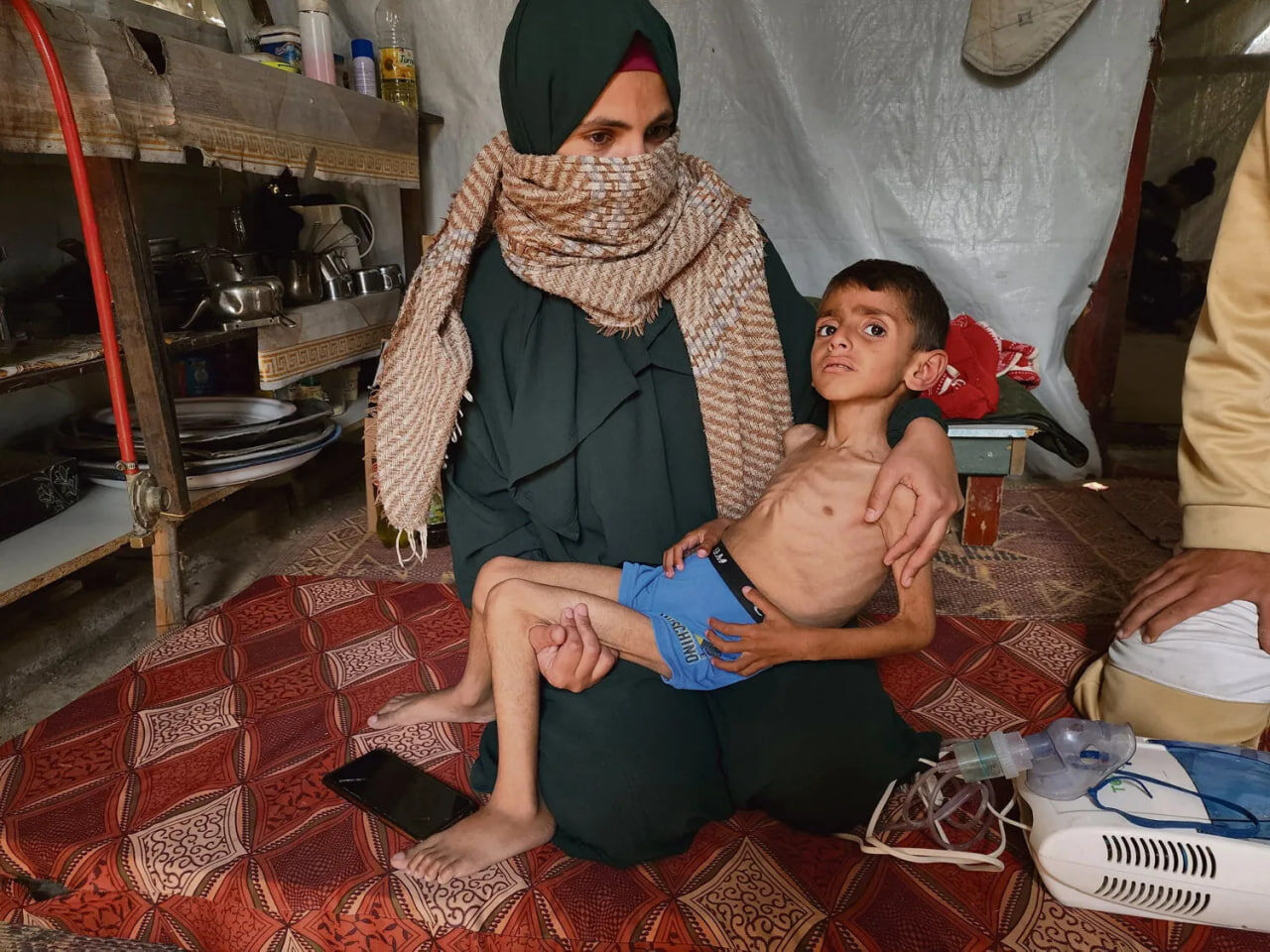 Gaza : La famine menace les Palestiniens, le silence de l’Occident face au génocide