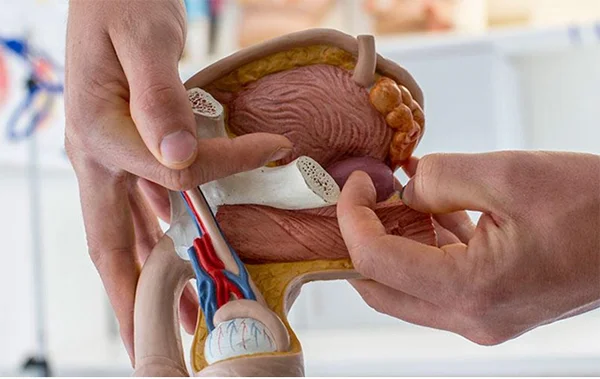 موفقیت دانشبنیانها در ساخت داروی گیاهی هایپرپلازی پروستات 1 موفقیت دانشبنیانها در ساخت داروی گیاهی هایپرپلازی پروستات