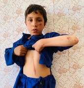 یک کودک در پکتیا از چنگ آدم‌ربایان نجات یافت