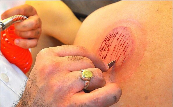 چگونه از سرماخوردگی در زمستان پیشگیری کنیم