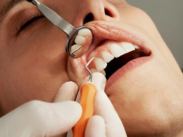 معاینه بدون درد لثه‌ با دستگاه سونوگرافی مسواک‌شکل