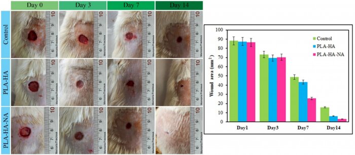 زخمپوشهایی که قادرند زخمهای مزمن را درمان و ترمیم کنند