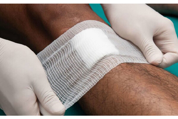 چگونه در منزل پانسمان اضطراری انجام دهیم