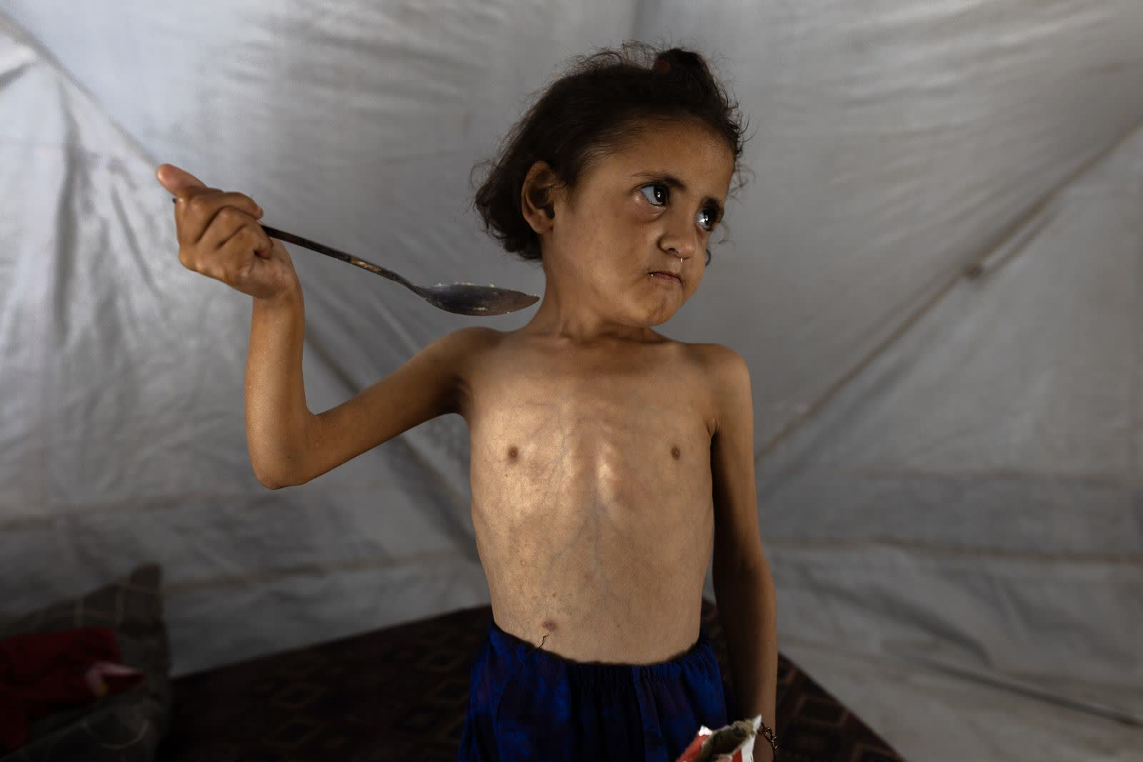 از قحطی تا مرگ؛ روایت تصویری فاجعه در غزه از نگاه عکاسان غربی