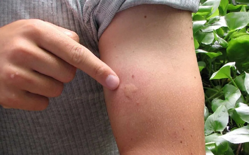 تابستان داغ، تلههای سلامتی؛ اشتباهات رایج که باید از آنها دوری کنید