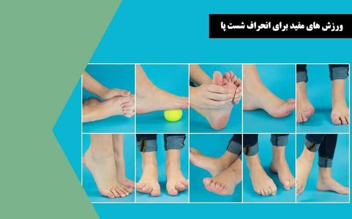 راهکارهایی ساده برای اصلاح انگشتان پا