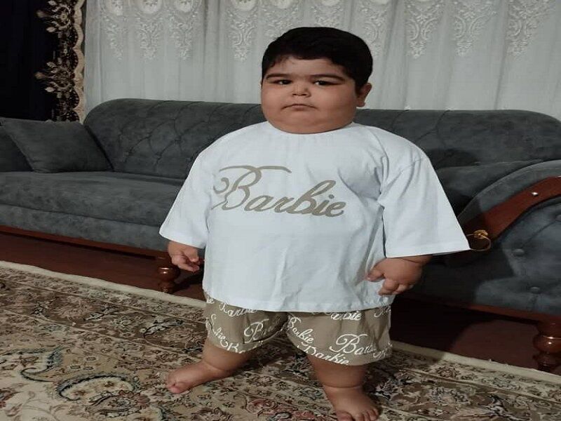 نبرد با چاقی، درد سنگین سامیار چهارساله