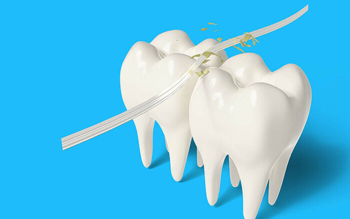 نخ دندان؛ مهمتر از آن چیزی که فکر میکنیم