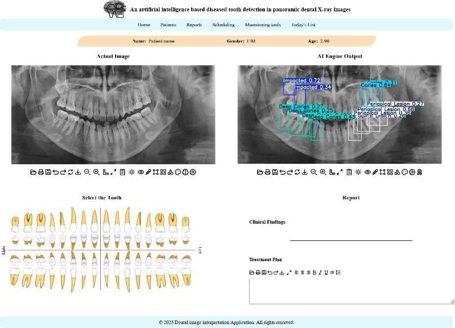توسعه سامانه هوشمند تحلیل تصاویر دندانپزشکی در دانشگاه تهران