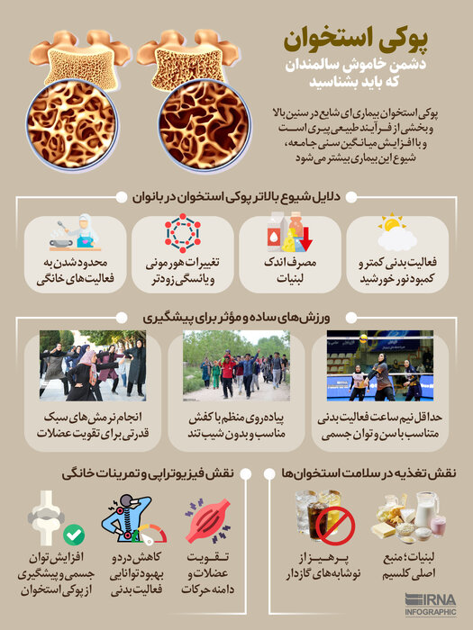 نمودار زندگی/ پوکی استخوان؛ دشمن خاموش سالمندی