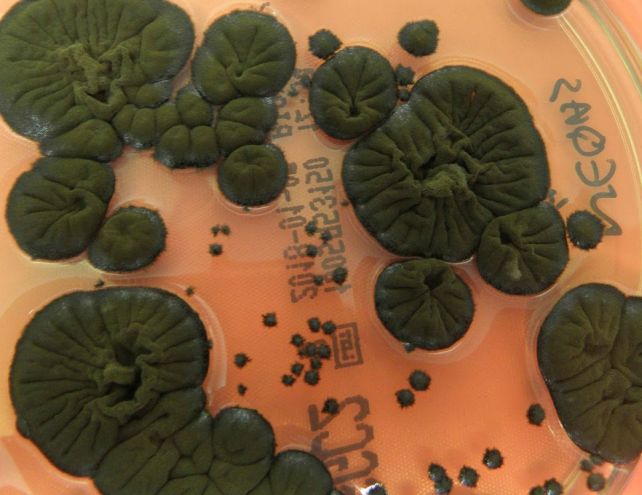 قارچ سیاه چرنوبیل: موجودی که تشعشعات هستهای را میخورد