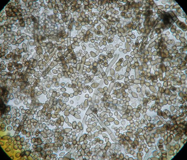 قارچ سیاه چرنوبیل: موجودی که تشعشعات هستهای را میخورد