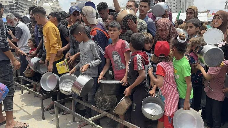 سایه شوم گرسنگی ، بیماری و مرگ بر کودکانِ بیپناه غزه