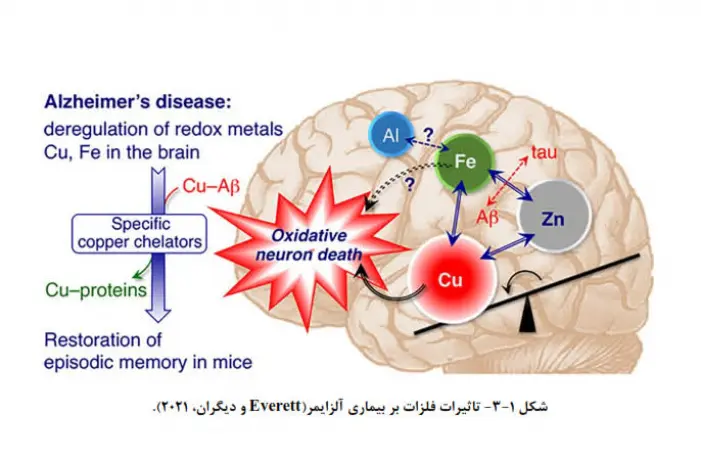 تشدید آلزایمر و نقش بازدارنده ترکیبات معطر گیاهی برای مقابله