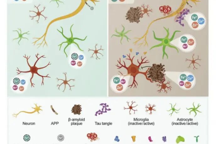 تشدید آلزایمر و نقش بازدارنده ترکیبات معطر گیاهی برای مقابله