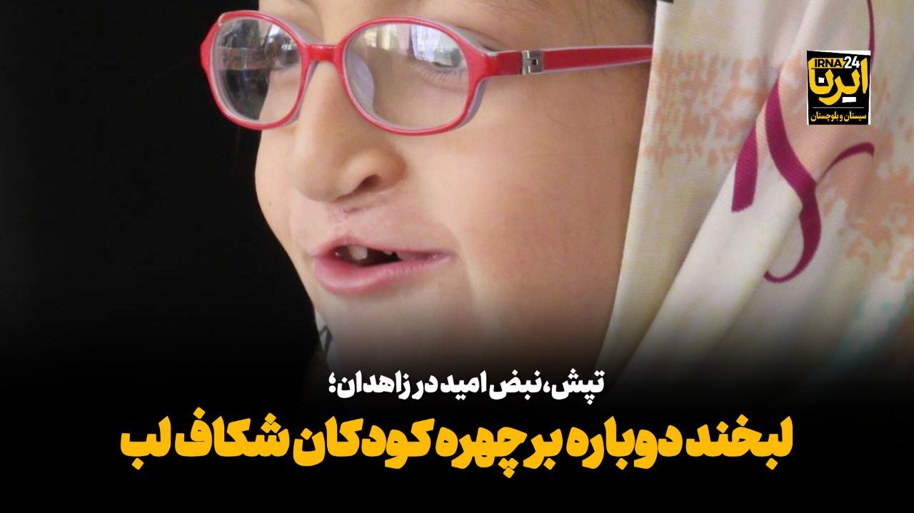 فیلم| تپش نبض امید در زاهدان؛ لبخند دوباره بر چهره کودکان شکاف لب