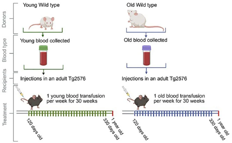 خون پیر، پیشرفت آلزایمر را تسریع میکند