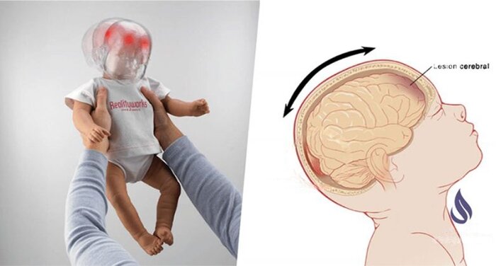 پرتاب به هوا؛ بازیای پرریسک برای کودکان