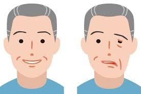 علامت هشدار سکته مغزی در ۹۰ روز آینده