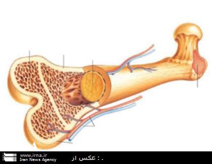 مغز استخوان از طريق سلولهاي بنيادي در مشهد پيوند زده شد
