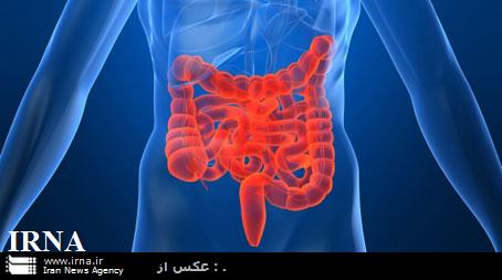 محققان اسپانيايي علت گسترش سرطان روده بزرگ را كشف كردند