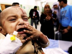كمبود تجهيزات پزشكي در بيمارستان هاي غزه به تراژدي تبديل مي شود