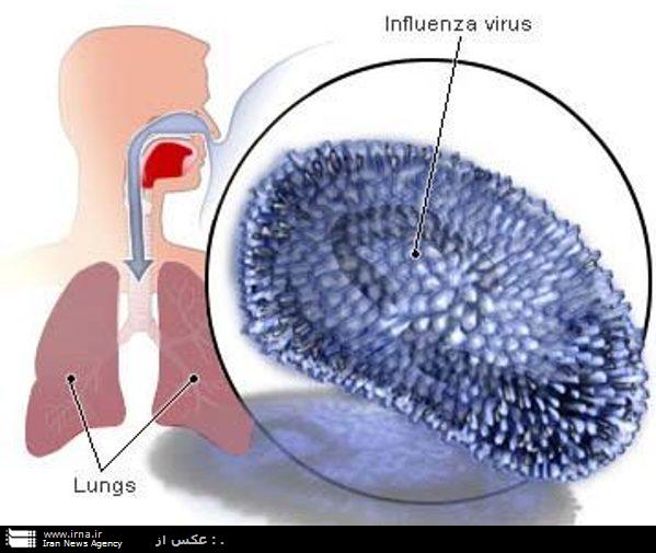 سردرد ناگهاني و درد عضلاني از علايم بروز بيماري آنفلوانزا است