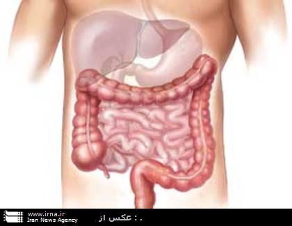 كم تحركي از علل بروز سرطان روده بزرگ است