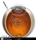 تزريق داخل چشمي روش جديد درمان رتينوپاتي ديابتي است