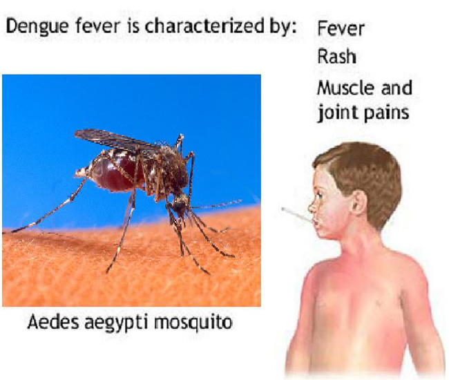 Delhi Dengue: Over 400 dengue cases reported in last three days