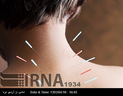 Acupuncture in modern medicine as auxiliary treatment Acupuncture in modern medicine as auxiliary treatment