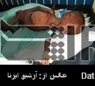 Iran prioritizes reduction of malnutrition Iran prioritizes reduction of malnutrition